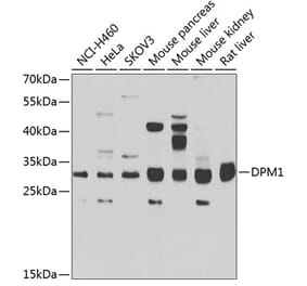 Western Blot - Anti-DPM1 Antibody (A15875) - Antibodies.com