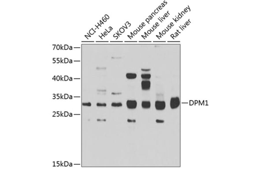 Western Blot - Anti-DPM1 Antibody (A15875) - Antibodies.com