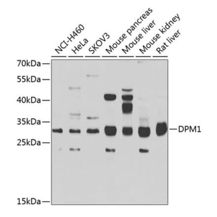 Western Blot - Anti-DPM1 Antibody (A15875) - Antibodies.com