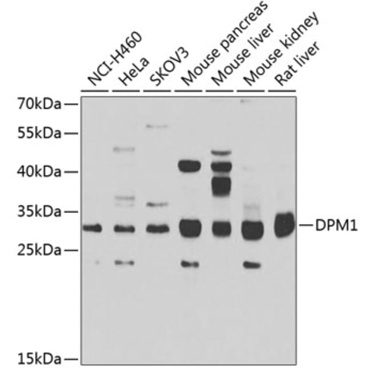 Western Blot - Anti-DPM1 Antibody (A15875) - Antibodies.com