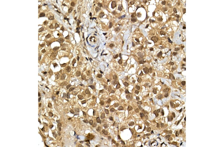 Immunohistochemistry - Anti-SQSTM1/p62 Antibody (A15876) - Antibodies.com
