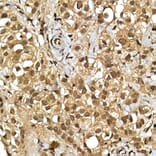 Immunohistochemistry - Anti-SQSTM1 / p62 Antibody (A15876) - Antibodies.com