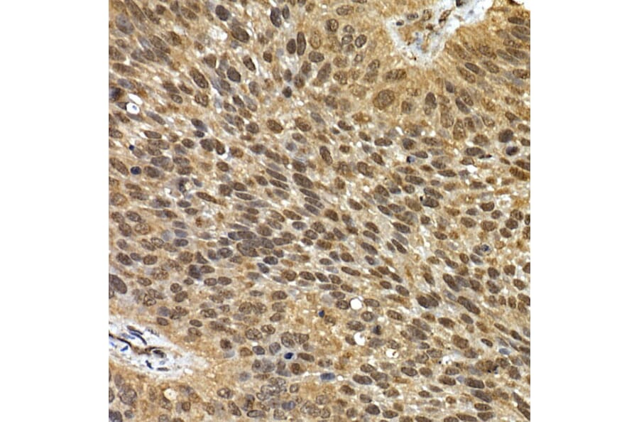 Immunohistochemistry - Anti-SQSTM1/p62 Antibody (A15876) - Antibodies.com