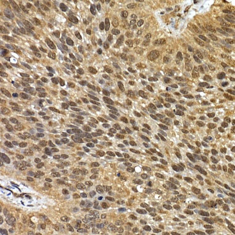 Immunohistochemistry - Anti-SQSTM1 / p62 Antibody (A15876) - Antibodies.com