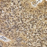 Immunohistochemistry - Anti-SQSTM1 / p62 Antibody (A15876) - Antibodies.com