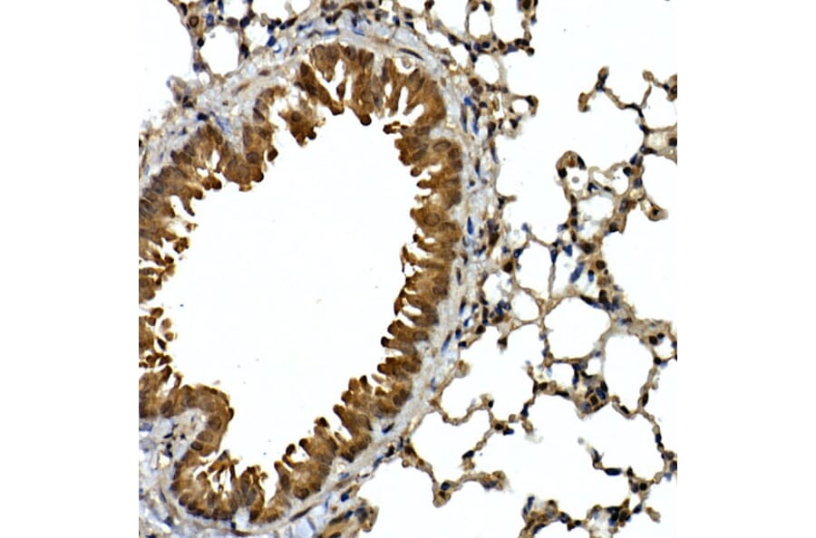 Immunohistochemistry - Anti-SQSTM1/p62 Antibody (A15876) - Antibodies.com