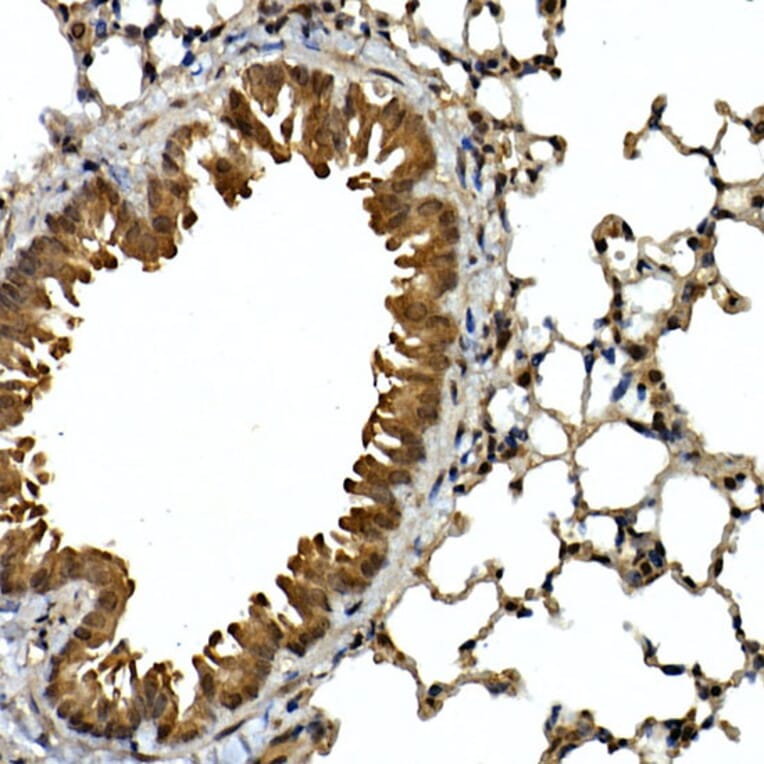 Immunohistochemistry - Anti-SQSTM1 / p62 Antibody (A15876) - Antibodies.com