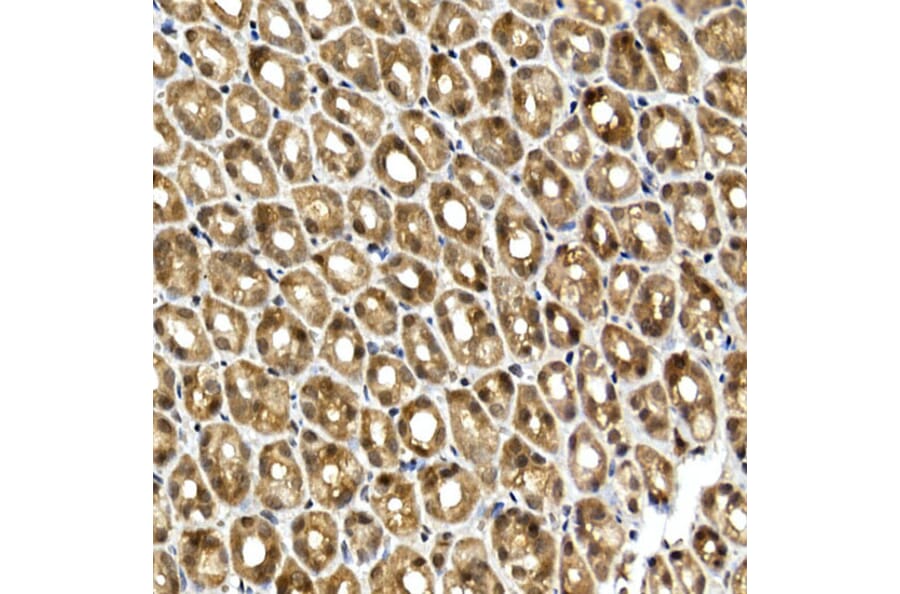 Immunohistochemistry - Anti-SQSTM1/p62 Antibody (A15876) - Antibodies.com