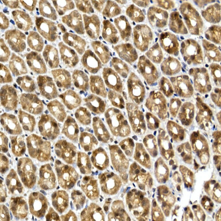 Immunohistochemistry - Anti-SQSTM1 / p62 Antibody (A15876) - Antibodies.com