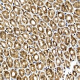 Immunohistochemistry - Anti-SQSTM1 / p62 Antibody (A15876) - Antibodies.com