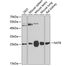 Western Blot - Anti-NAT8 Antibody (A15877) - Antibodies.com