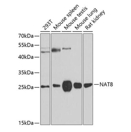 Western Blot - Anti-NAT8 Antibody (A15877) - Antibodies.com