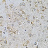 Immunohistochemistry - Anti-NAT8 Antibody (A15877) - Antibodies.com