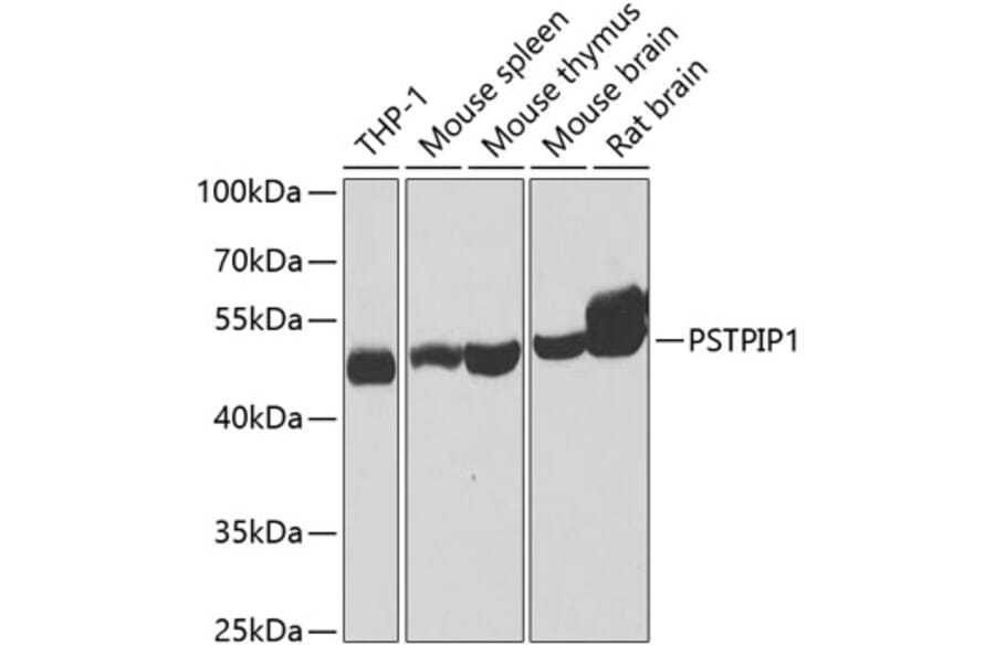 Western Blot - Anti-PSTPIP1 Antibody (A15878) - Antibodies.com