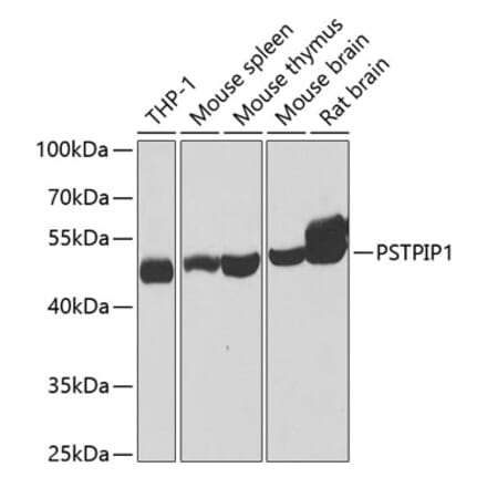 Western Blot - Anti-PSTPIP1 Antibody (A15878) - Antibodies.com