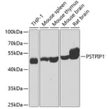 Western Blot - Anti-PSTPIP1 Antibody (A15878) - Antibodies.com
