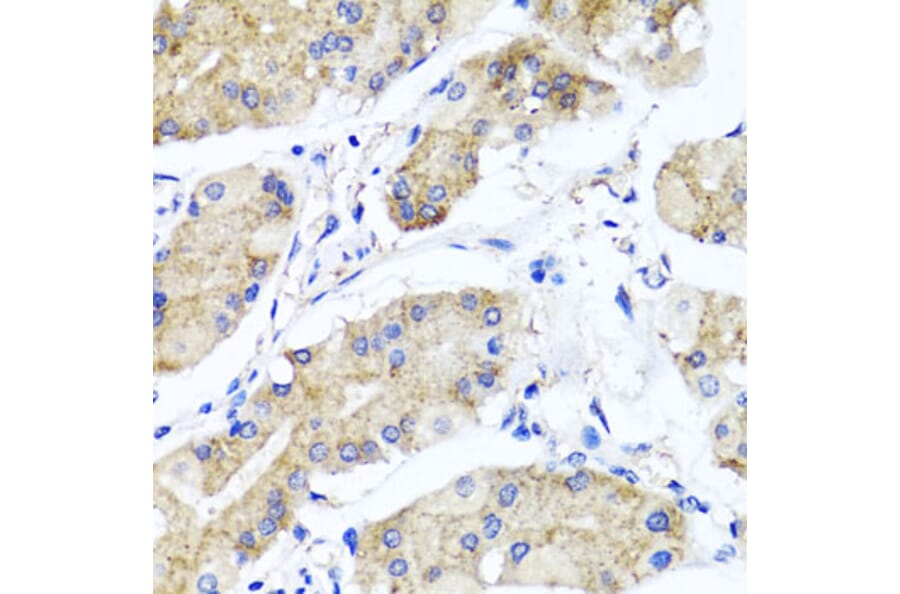 Immunohistochemistry - Anti-PSTPIP1 Antibody (A15878) - Antibodies.com