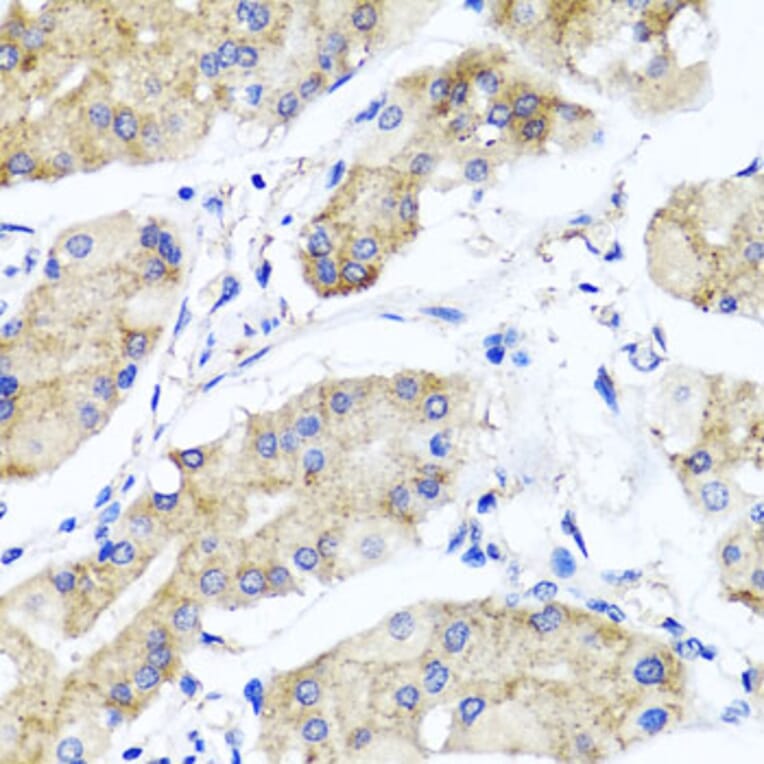 Immunohistochemistry - Anti-PSTPIP1 Antibody (A15878) - Antibodies.com