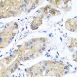 Immunohistochemistry - Anti-PSTPIP1 Antibody (A15878) - Antibodies.com