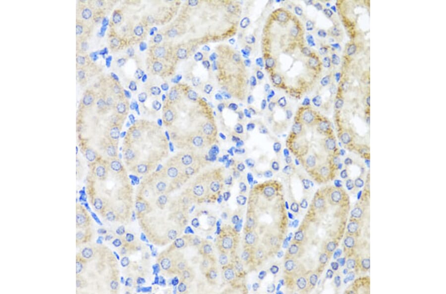 Immunohistochemistry - Anti-PSTPIP1 Antibody (A15878) - Antibodies.com