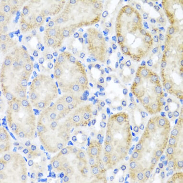 Immunohistochemistry - Anti-PSTPIP1 Antibody (A15878) - Antibodies.com