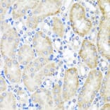 Immunohistochemistry - Anti-PSTPIP1 Antibody (A15878) - Antibodies.com