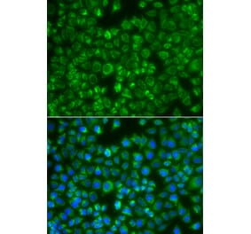 Immunofluorescence - Anti-MTMR4 Antibody (A7761) - Antibodies.com