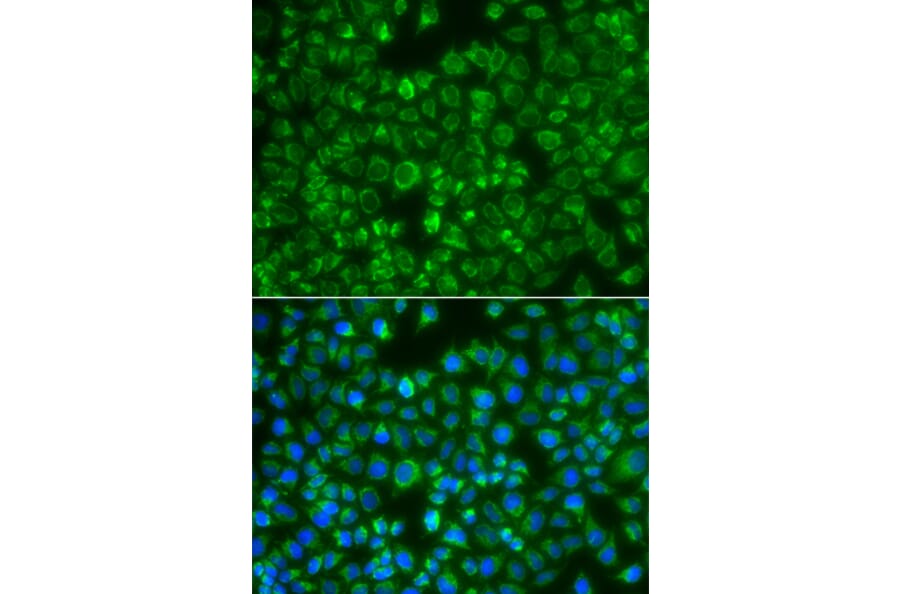 Immunofluorescence - Anti-MTMR4 Antibody (A7761) - Antibodies.com