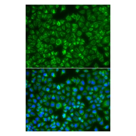 Immunofluorescence - Anti-MTMR4 Antibody (A7761) - Antibodies.com