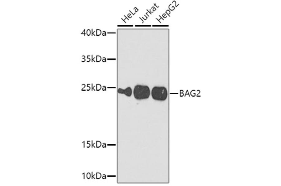 Western Blot - Anti-BAG2 Antibody (A15880) - Antibodies.com
