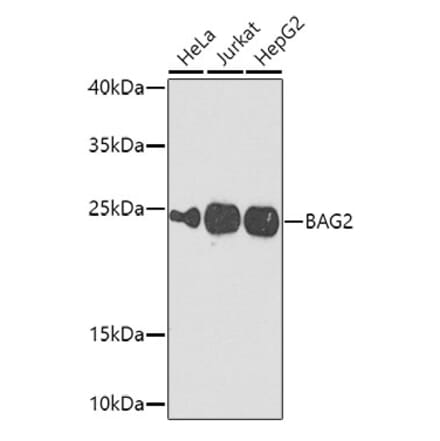 Western Blot - Anti-BAG2 Antibody (A15880) - Antibodies.com