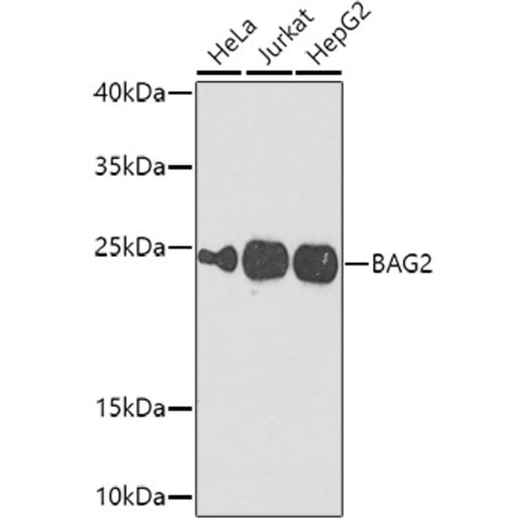 Western Blot - Anti-BAG2 Antibody (A15880) - Antibodies.com