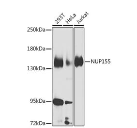 Western Blot - Anti-NUP155 Antibody (A15881) - Antibodies.com