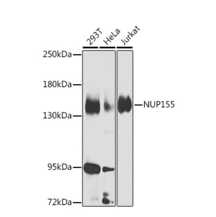 Western Blot - Anti-NUP155 Antibody (A15881) - Antibodies.com