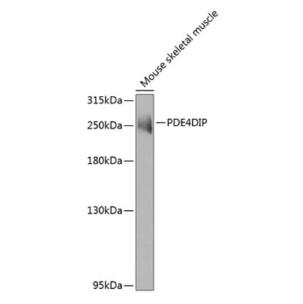 Western Blot - Anti-PDE4DIP Antibody (A15882) - Antibodies.com