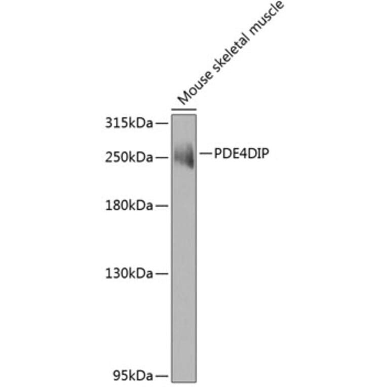 Western Blot - Anti-PDE4DIP Antibody (A15882) - Antibodies.com