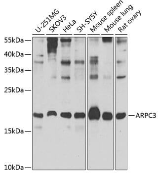 Western blot analysis of extracts of various cell lines, using Anti-ARPC3 Antibody (A7767) at 1:1,000 dilution.
Secondary antibody: Goat Anti-Rabbit IgG (H+L) (HRP) (AS014) at 1:10,000 dilution.
Lysates / proteins: 25µg per lane.
Blocking buffer: 3% non-fat dry milk in TBST.
Detection: ECL Basic Kit (RM00020).
Exposure time: 30s.
