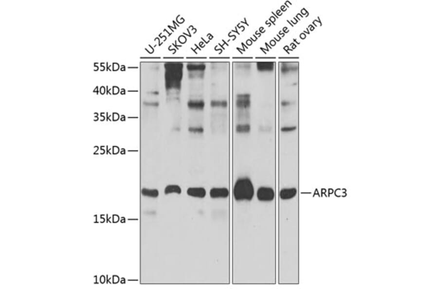 Western Blot - Anti-p21-ARC/ARPC3 Antibody (A15883) - Antibodies.com