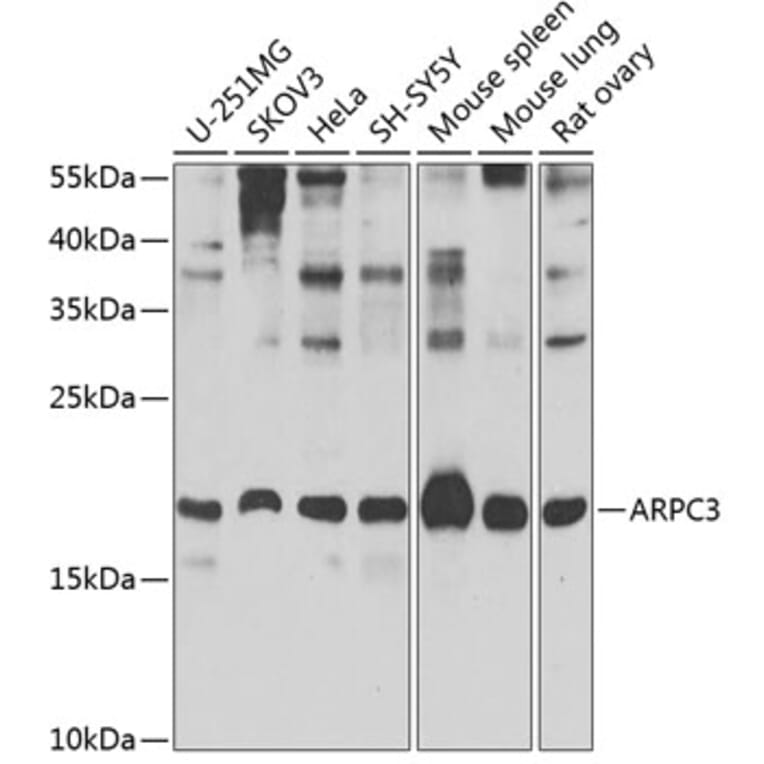 Western Blot - Anti-p21-ARC/ARPC3 Antibody (A15883) - Antibodies.com