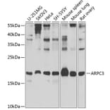 Western Blot - Anti-p21-ARC/ARPC3 Antibody (A15883) - Antibodies.com