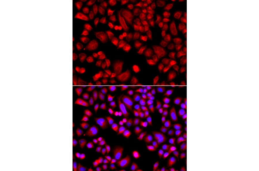 Immunofluorescence - Anti-p21-ARC/ARPC3 Antibody (A15883) - Antibodies.com