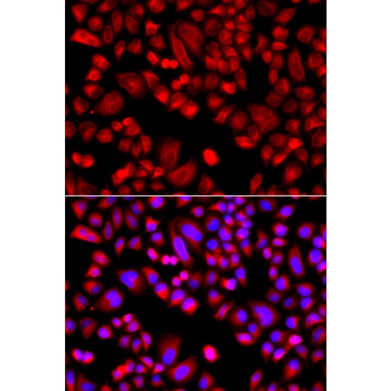 Immunofluorescence - Anti-p21-ARC/ARPC3 Antibody (A15883) - Antibodies.com