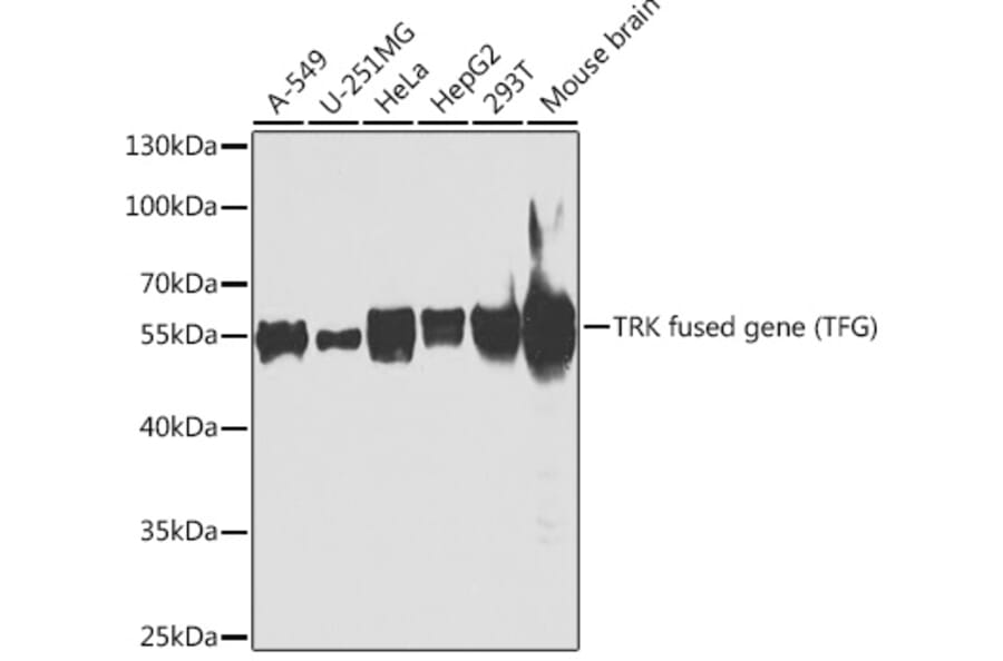 Western Blot - Anti-TRK fused gene Antibody (A15884) - Antibodies.com