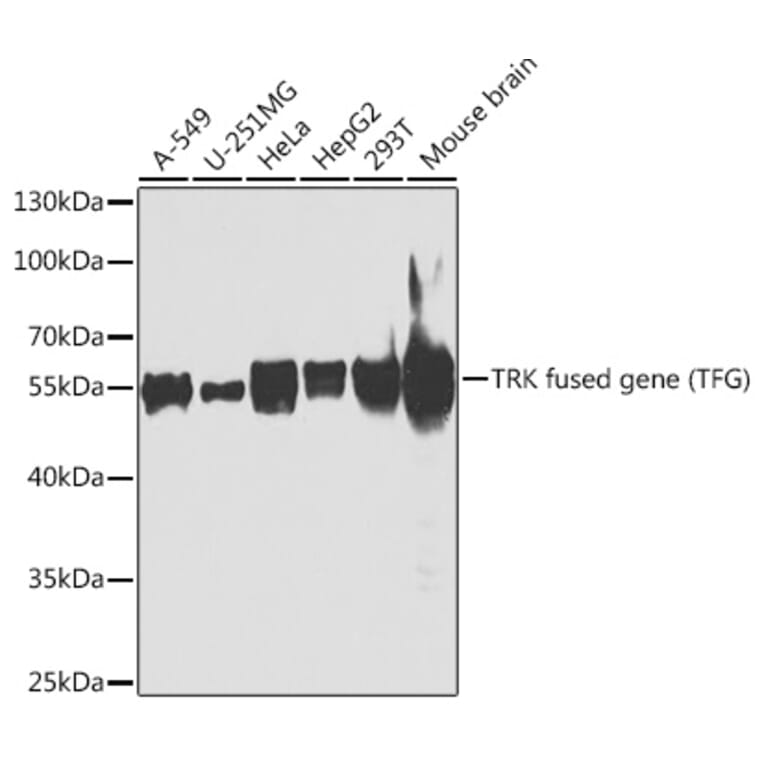 Western Blot - Anti-TRK fused gene Antibody (A15884) - Antibodies.com