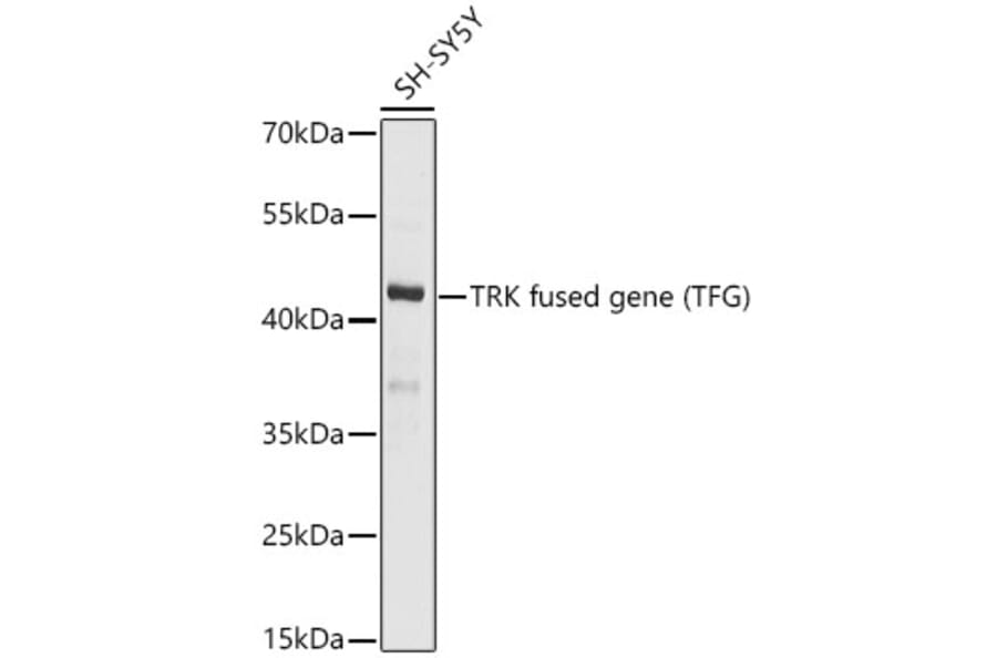 Western Blot - Anti-TRK fused gene Antibody (A15884) - Antibodies.com