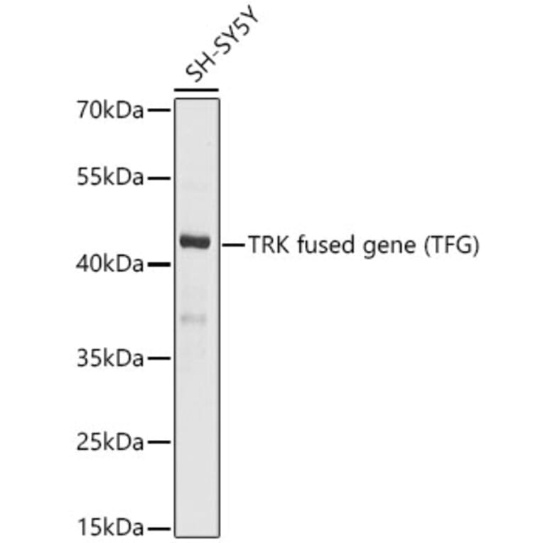 Western Blot - Anti-TRK fused gene Antibody (A15884) - Antibodies.com