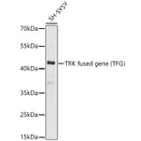 Western Blot - Anti-TRK fused gene Antibody (A15884) - Antibodies.com