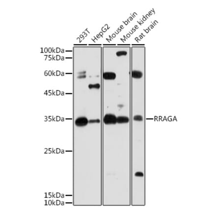 Western Blot - Anti-Rag A Antibody (A15885) - Antibodies.com