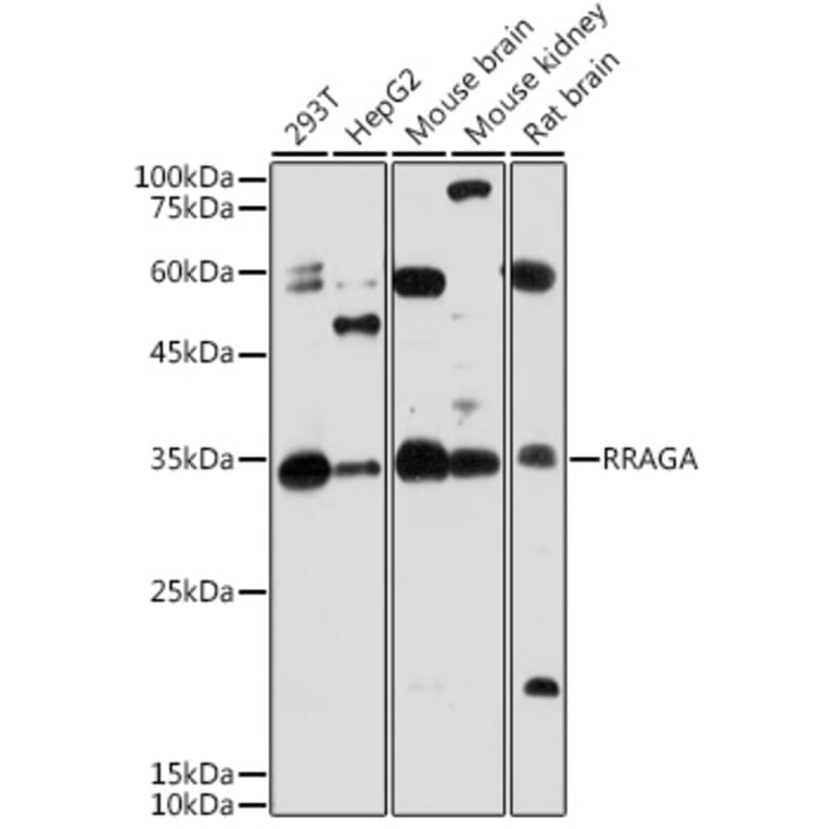 Western Blot - Anti-Rag A Antibody (A15885) - Antibodies.com
