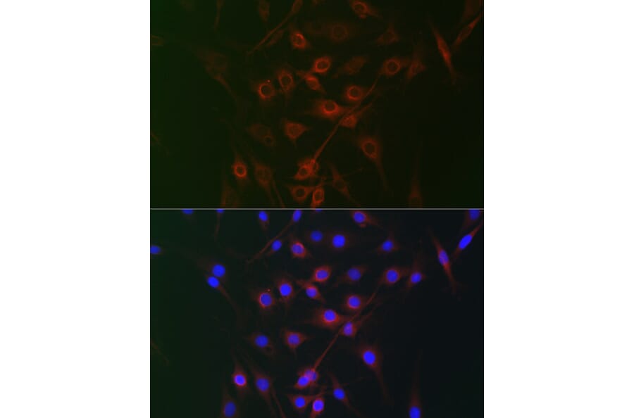 Immunofluorescence - Anti-Rag A Antibody (A15885) - Antibodies.com